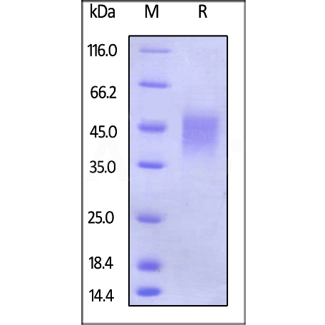 Human Fc gamma RIIIB / CD16b (NA2) Protein, His Tag (百普赛斯 CDB-H5222)