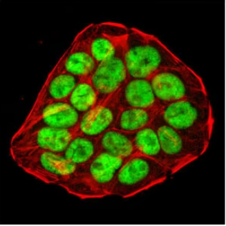 p53 (1C12) Mouse mAb(CST 2524T)