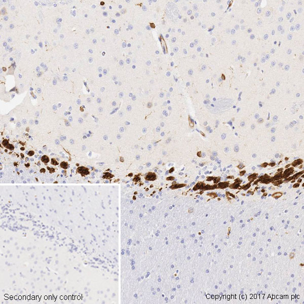 重组Anti-Doublecortin抗体[EPR19997] (ab207175)