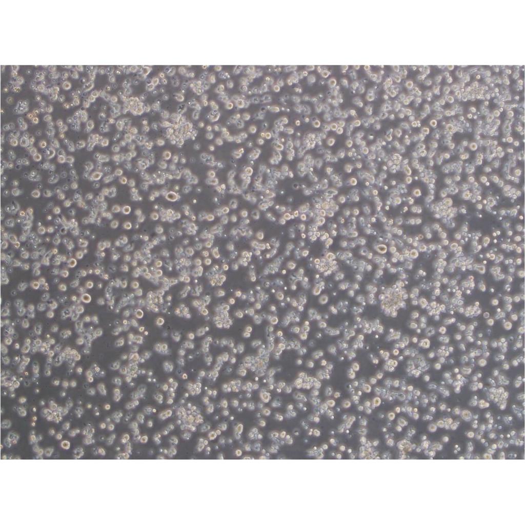 NK10a Cell人Burkkit淋巴瘤悬浮细胞