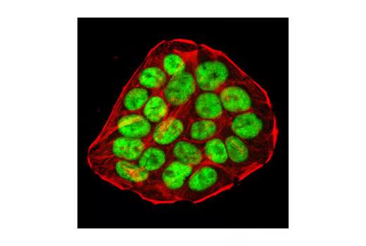 14362ab9702390b5ec55fca1581fb1c.png 14362ab9702390b5ec55fca1581fb1c.png