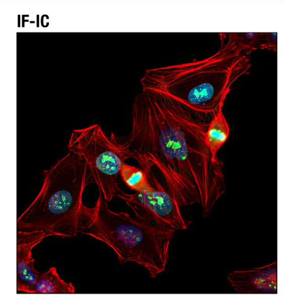 Ki-67 (D3B5) 兔单克隆抗体