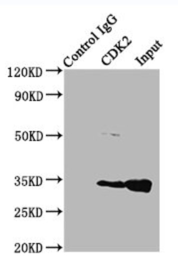 细胞周期蛋白依赖性激酶2/细胞周期蛋白E1复合物（CDK2/CycE1）