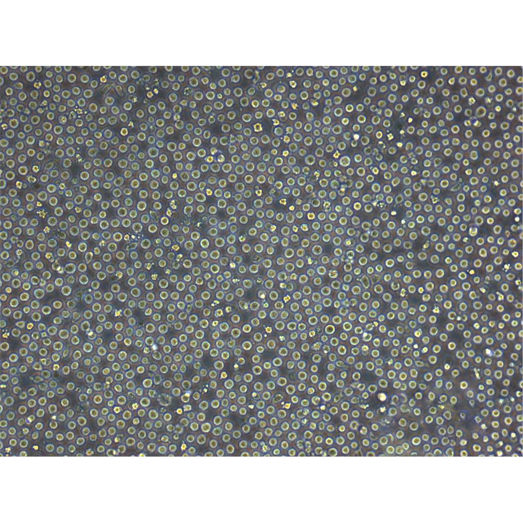 MOLT 4 Cell人急性淋巴母细胞性白血病悬浮细胞