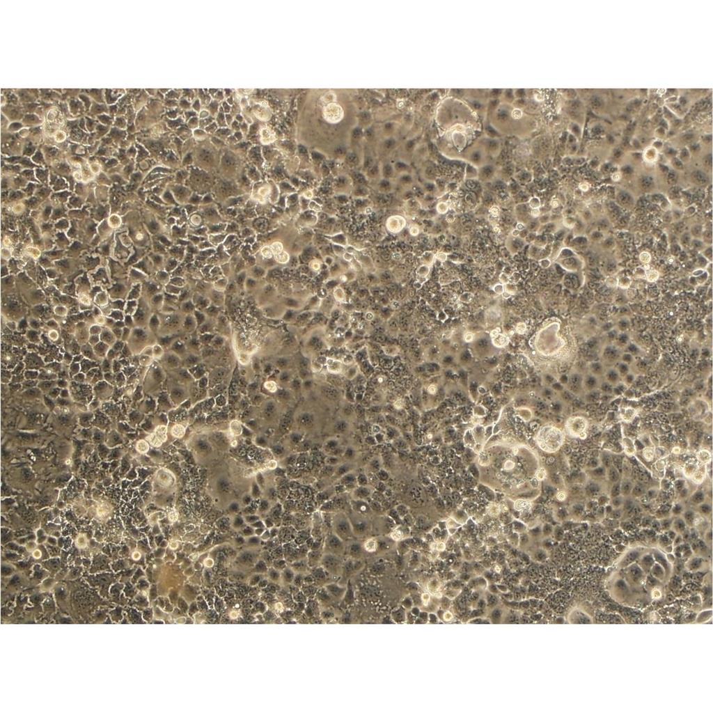 B104 Cells#大鼠神经母细胞瘤细胞系保种中心(通过STR鉴定)