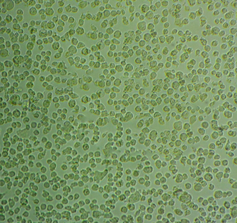 J82 Cells#人膀胱移行癌细胞系保种中心(通过STR鉴定)