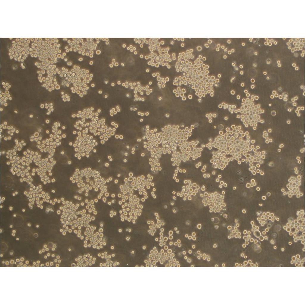 P3X63Ag8 Cells:小鼠骨髓瘤细胞系代次低(带STR鉴定报告)