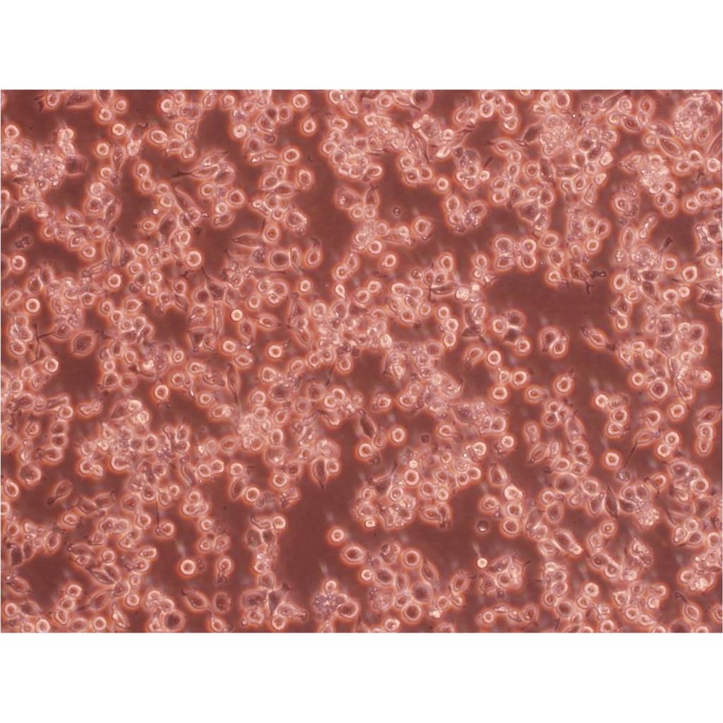 CL-11 Cells:人结肠癌细胞系代次低(带STR鉴定报告)