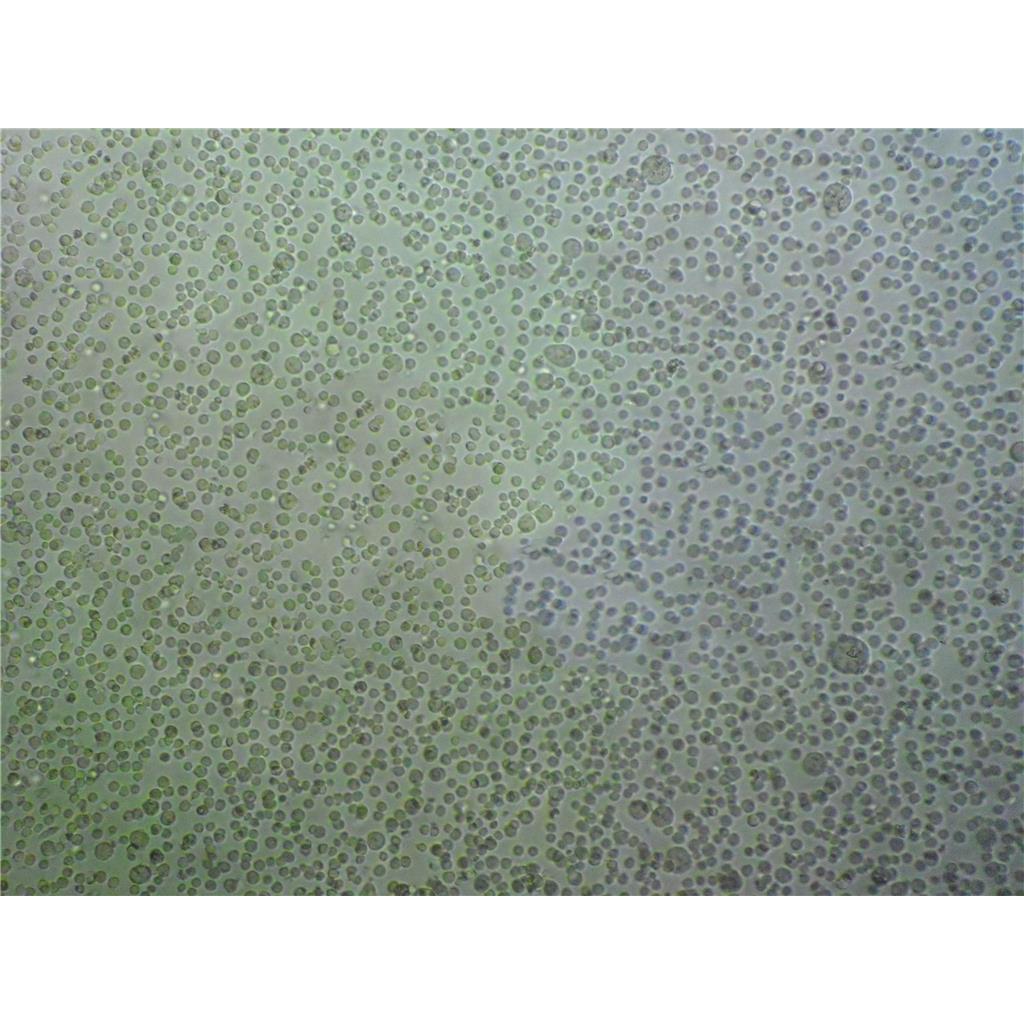 Panc 08.13 Cells:人胰腺癌细胞系代次低(带STR鉴定报告)