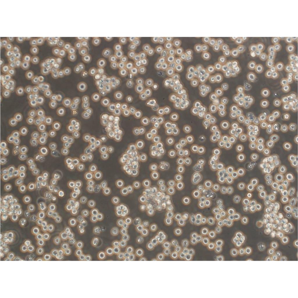 MCF-12A Cells:人乳腺上皮细胞系代次低(带STR鉴定报告)