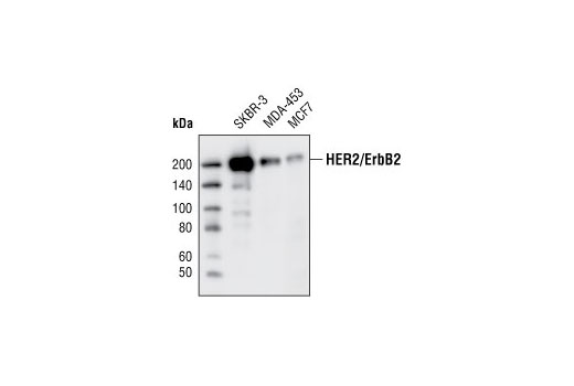 HER2/ErbB2 (29D8) 兔单克隆抗体