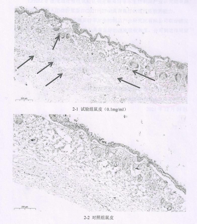 重组人源化弹性蛋白