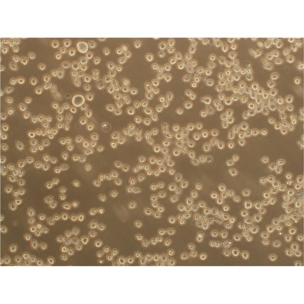 NCI-H2452[H2452] Cells:人间皮瘤细胞系代次低(带STR鉴定报告)