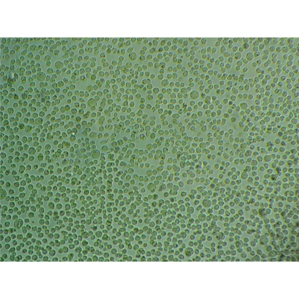 HCC 94[HCC941122] Cells:人子宫鳞癌细胞系代次低<高分化>(带STR鉴定报告)