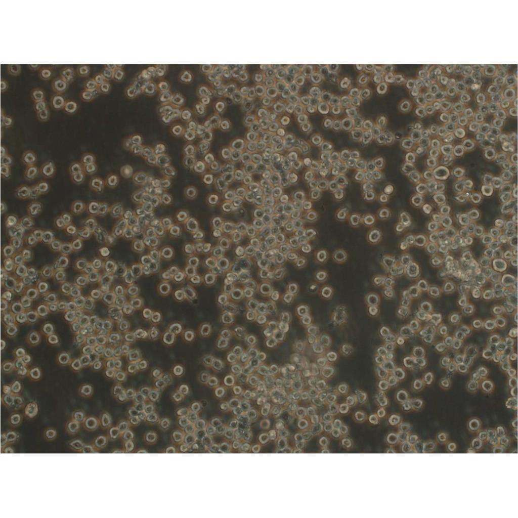 NCI-H1395 Cells:人肺腺癌细胞系代次低(带STR鉴定报告)