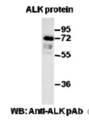 Anti Ras(G13D) Mouse Monoclonal Antibody