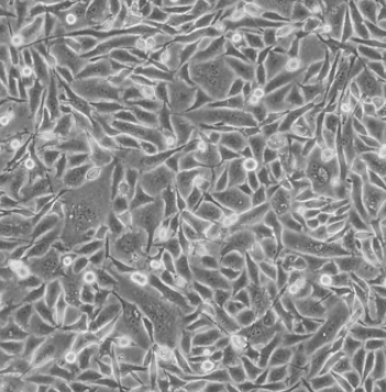 Mortierella Minutissima Var. Dubia