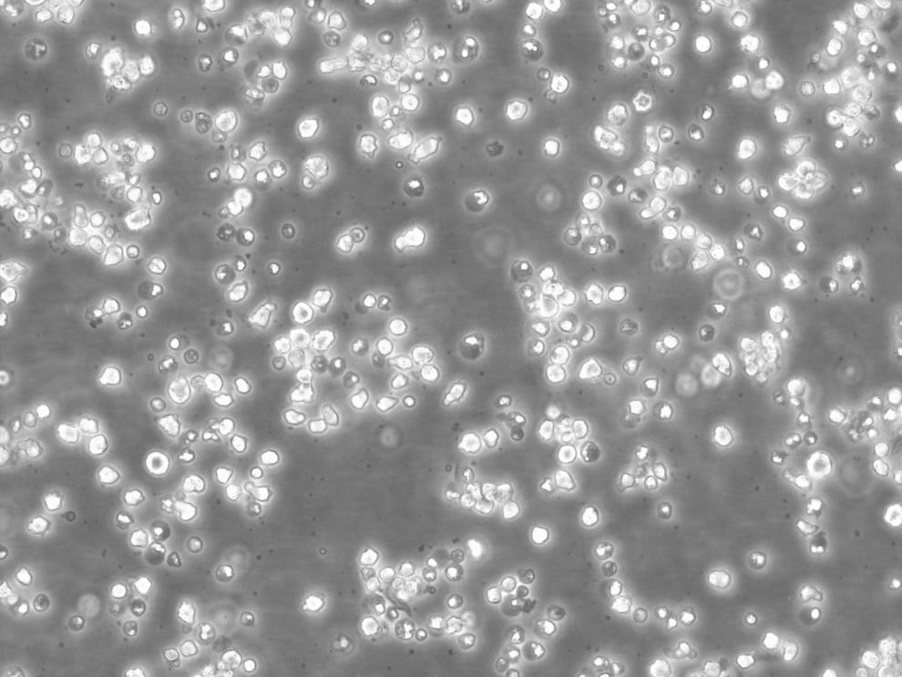 CCRF S-180 II Cells小鼠腹水瘤细胞复苏实验室|STR图谱