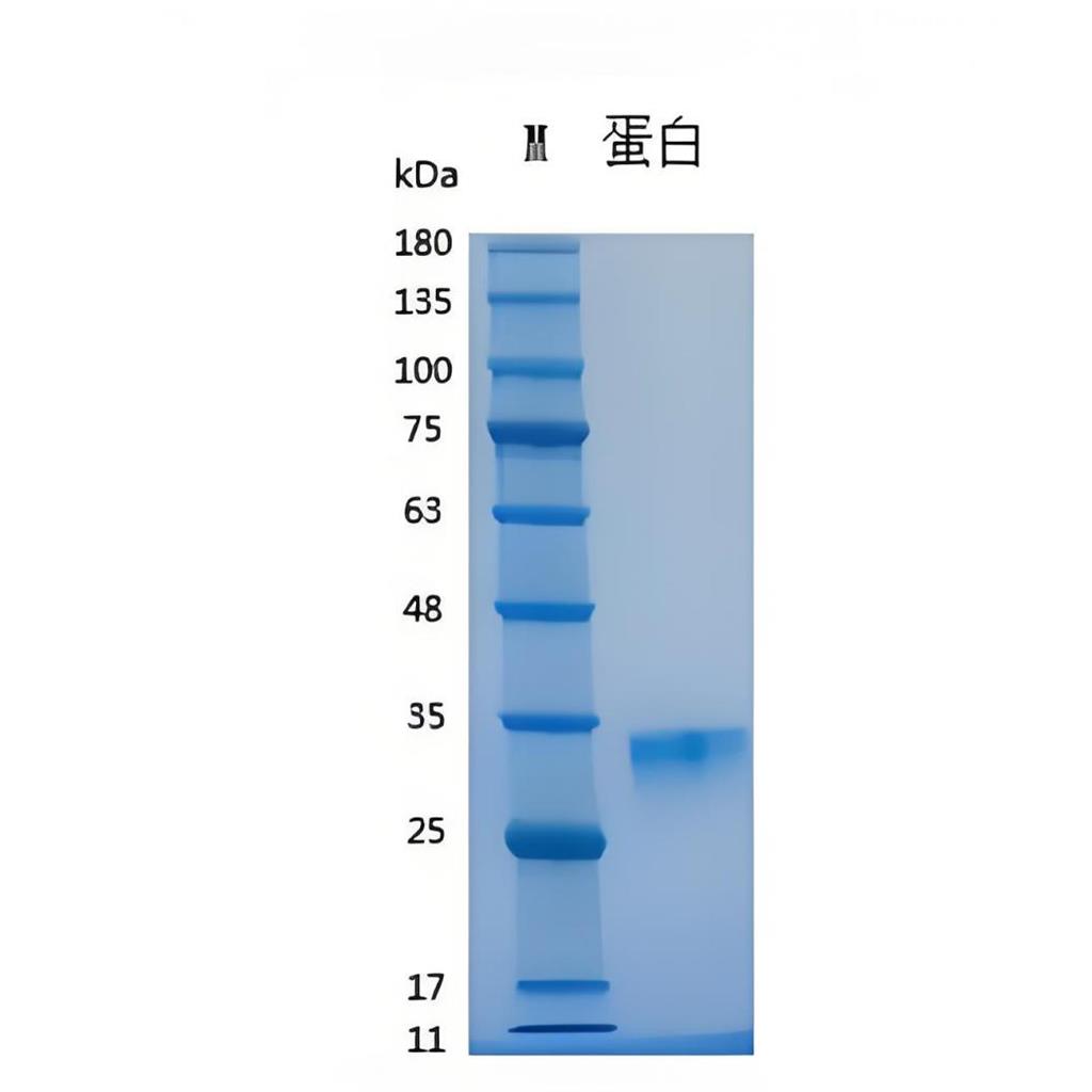 Recombinant Human OSM重组人肿瘤抑制素M