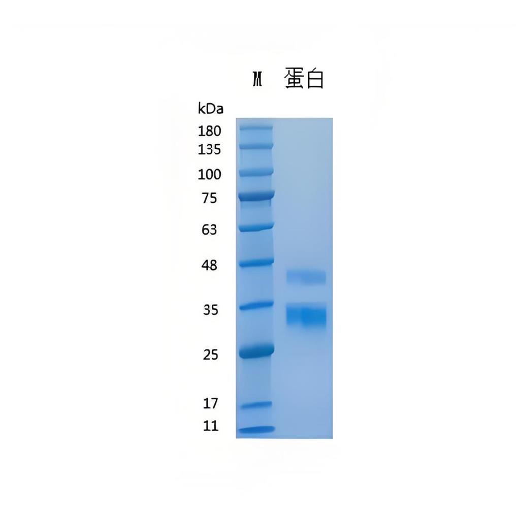 Recombinant Human R-Spondin1重组人R-Spondin1蛋白