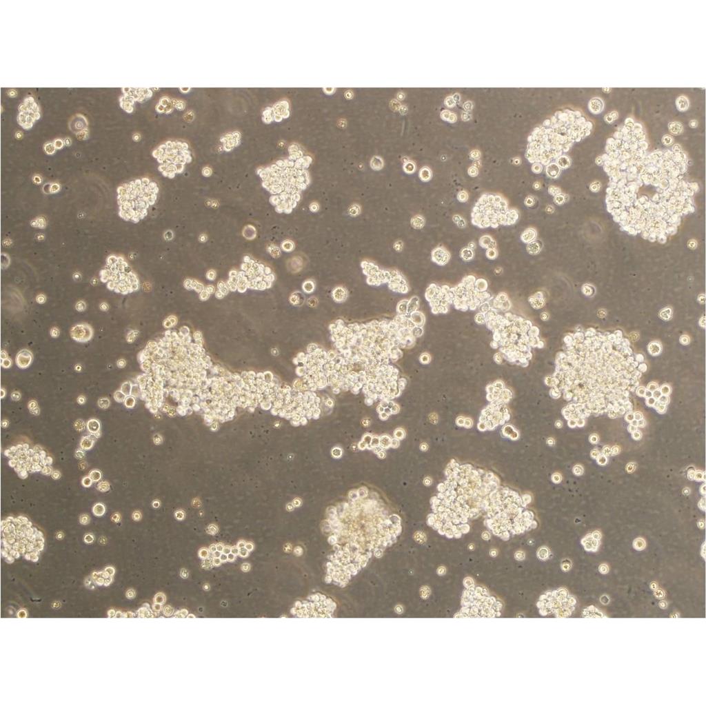 92-1 [Human uveal melanoma] Cells人眼葡萄膜黑色素瘤细胞专业复苏|STR图谱