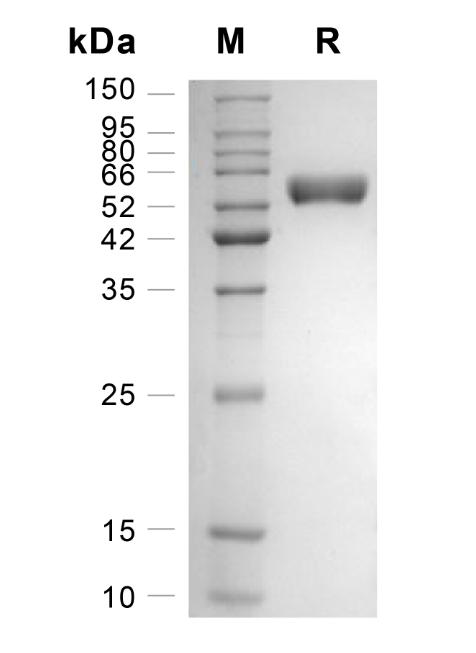 Recombinant Human Fibronectin-E. coli重组人纤连蛋白