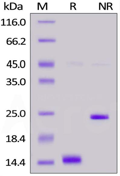 Recombinant Human IL-21重组人白介素-21