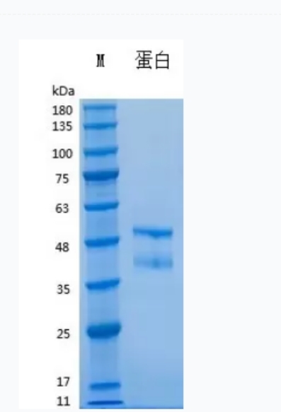 Recombinant Human IL-21（Fc Tag）重组人白介素-21