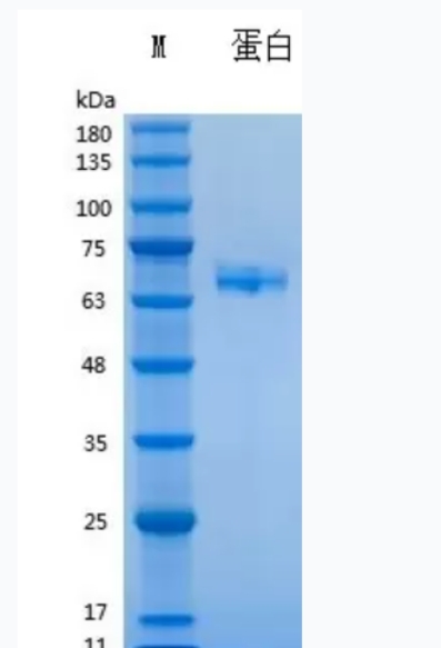 Recombinant Human IL-23重组人白介素-23