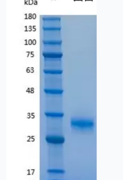 Recombinant Human Noggin 重组人Noggin蛋白