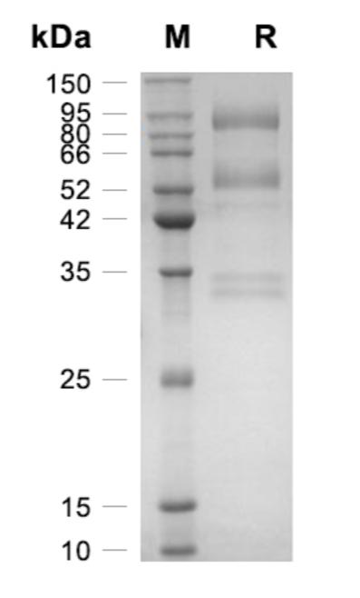 Recombinant Human HGF重组人肝细胞生长因子