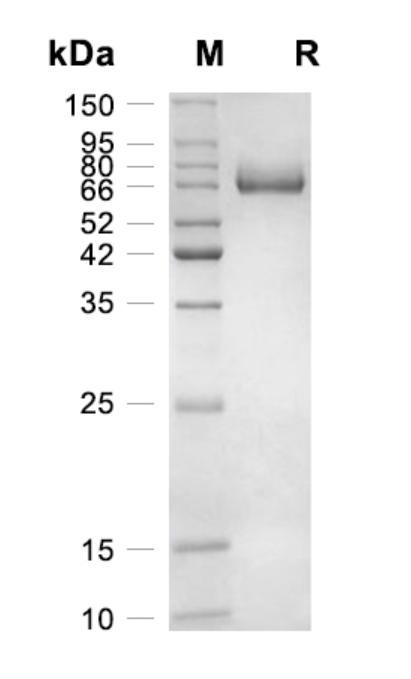 Recombinant Human IL-12重组人白介素-12