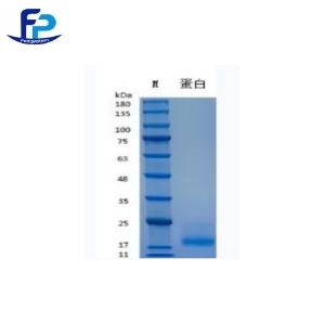 Recombinant Human IL-15重组人白介素-15