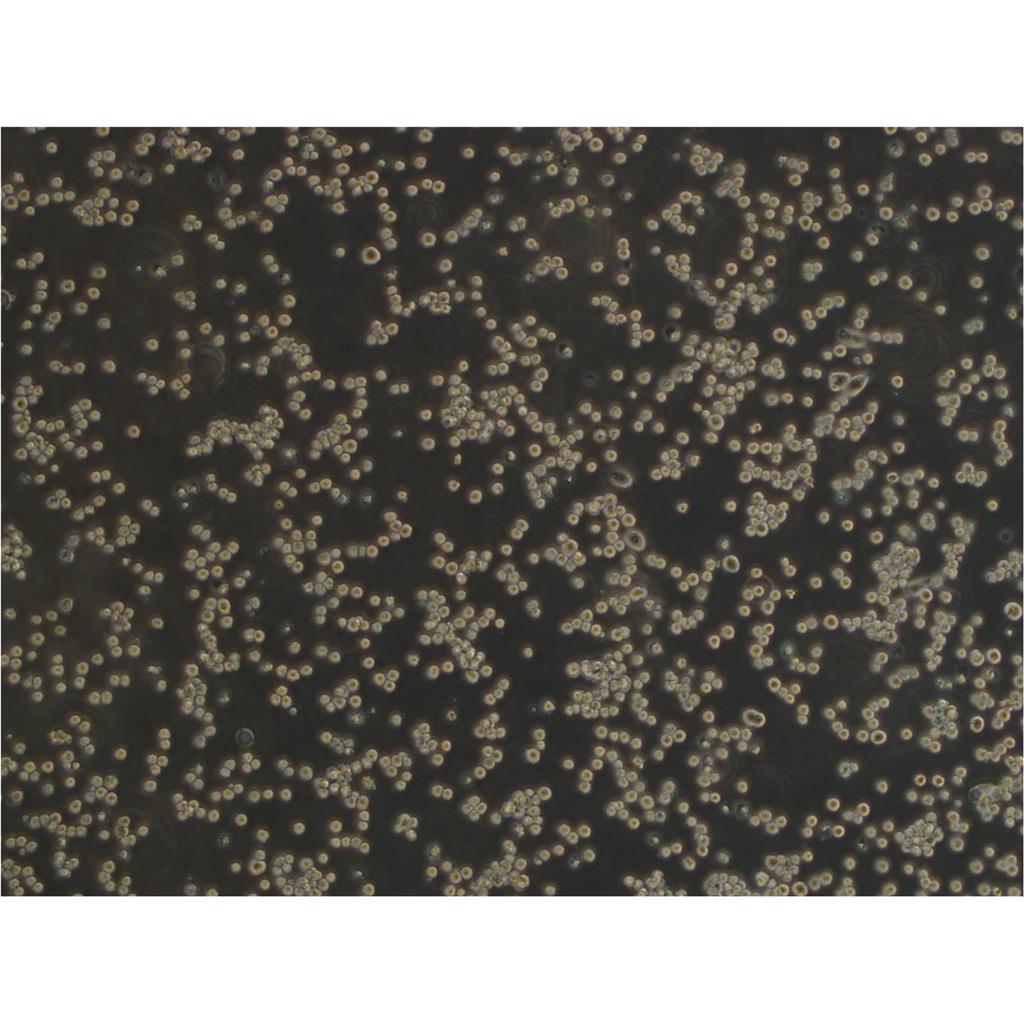 HCC4006 Cells人肺癌腺癌细胞ATCC保种|STR图谱