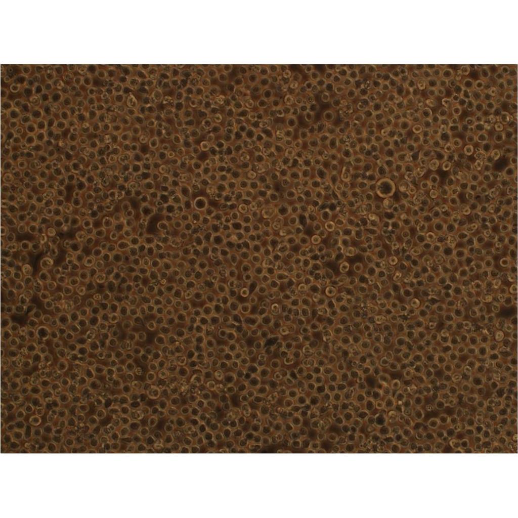NCI-H1793 Cells人肺癌细胞低代次保种|STR图谱