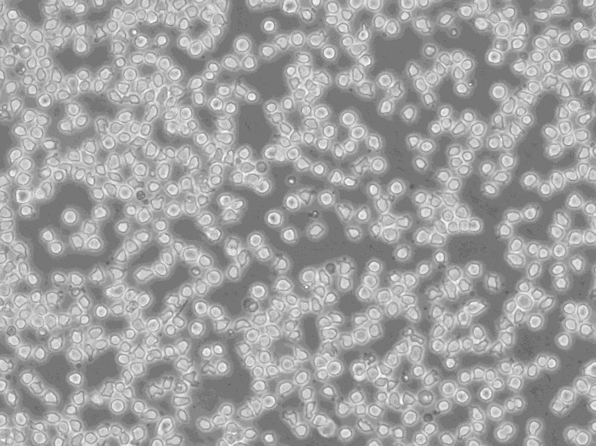 HFL1 Cells人胚肺成纤维细胞低代次保种|STR图谱