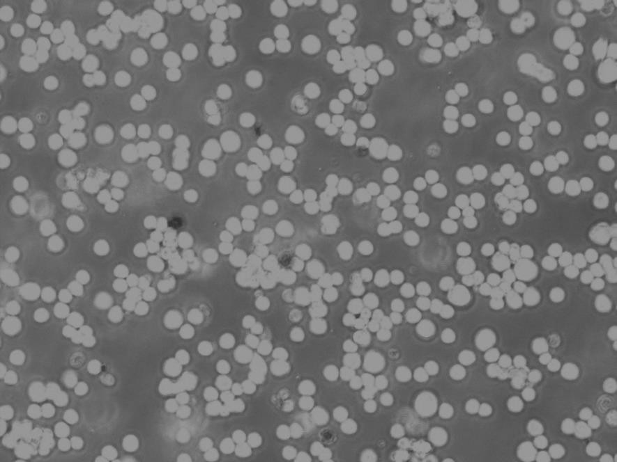 LS174T Cells人结肠腺癌细胞低代次复苏|STR图谱