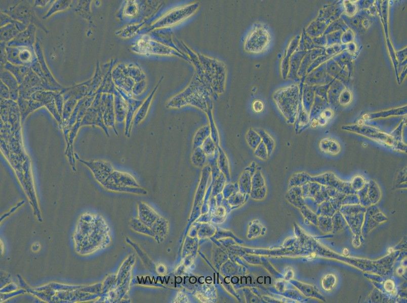 NCI-H446 细胞[H446细胞] (人小细胞肺癌细胞) (STR鉴定正确)CL-0401