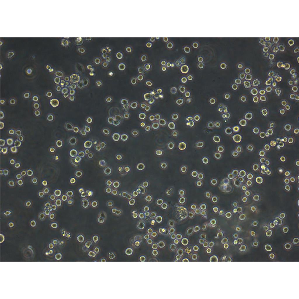 NCI-H1703 Cells人肺癌细胞专业复苏|STR图谱