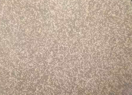 THP-1人单核细胞白血病细胞