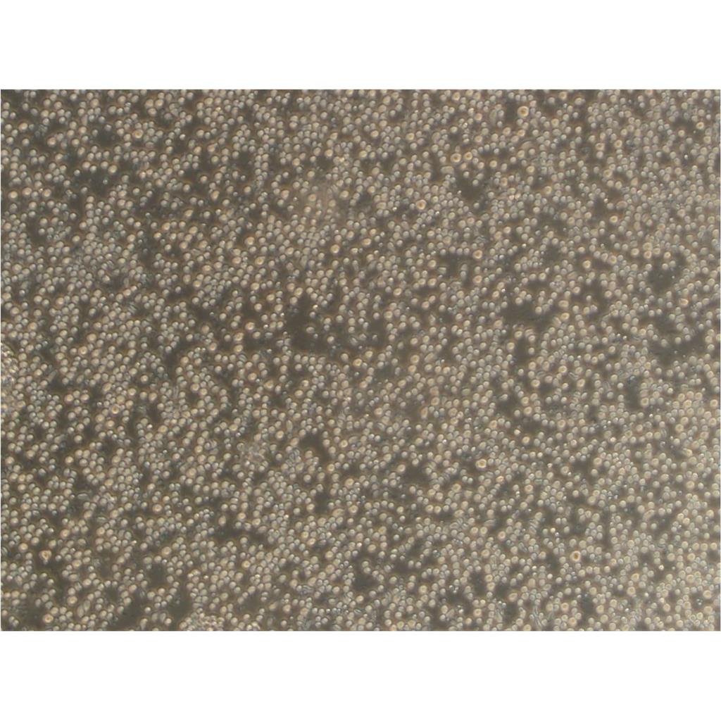 SW1710 Cells人膀胱癌细胞传代率高|STR图谱