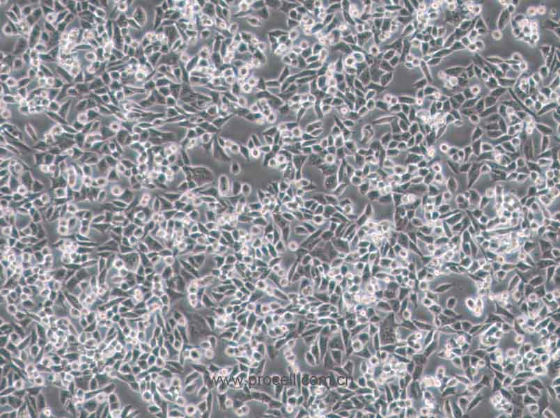 4T1(小鼠乳腺癌细胞) (STR鉴定正确)CL-0007