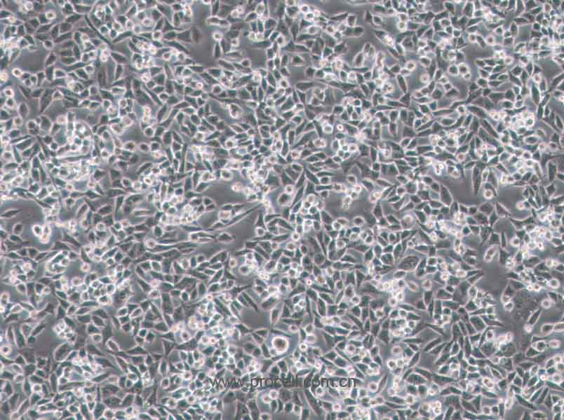 4T1(小鼠乳腺癌细胞) (STR鉴定正确)CL-0007