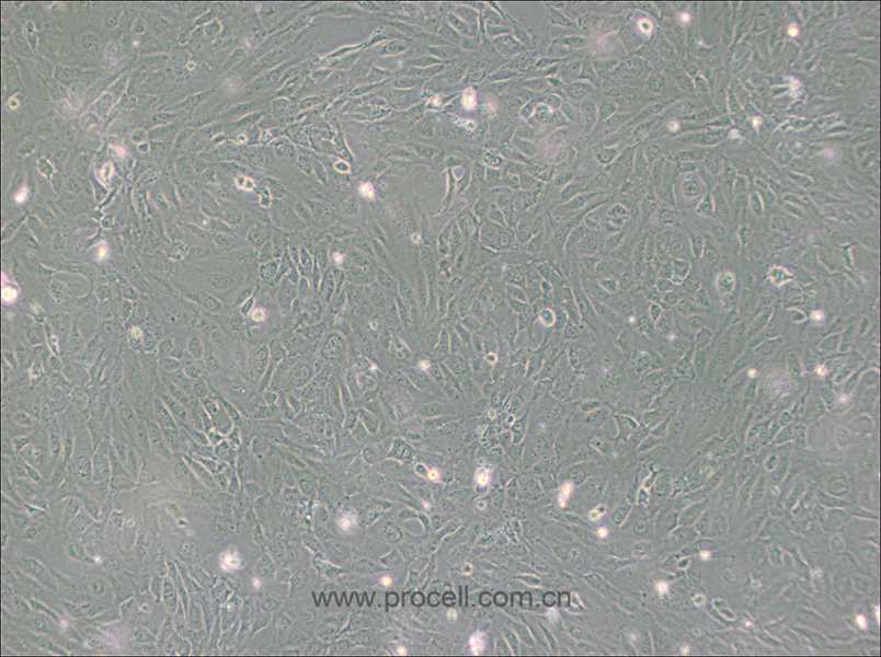 PUMC-HUVEC-T1细胞 (SV40T转化人脐静脉内皮细胞) (STR鉴定正确)CL-0675