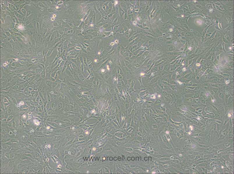 PUMC-HUVEC-T1细胞 (SV40T转化人脐静脉内皮细胞) (STR鉴定正确)CL-0675
