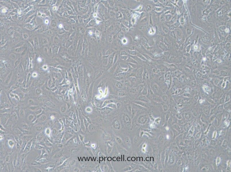 LX-2细胞 (人肝星形细胞) (STR鉴定正确)CL-0560