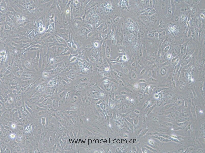LX-2细胞 (人肝星形细胞) (STR鉴定正确)CL-0560