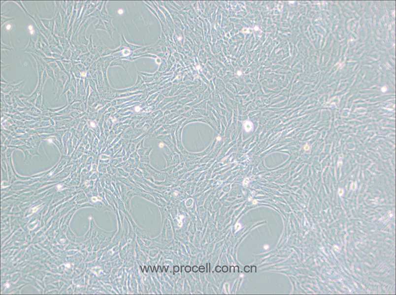 HT22细胞 (小鼠海马神经元细胞) (STR鉴定正确)CL-0697