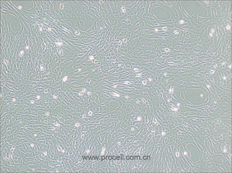 HT22细胞 (小鼠海马神经元细胞) (STR鉴定正确)CL-0697