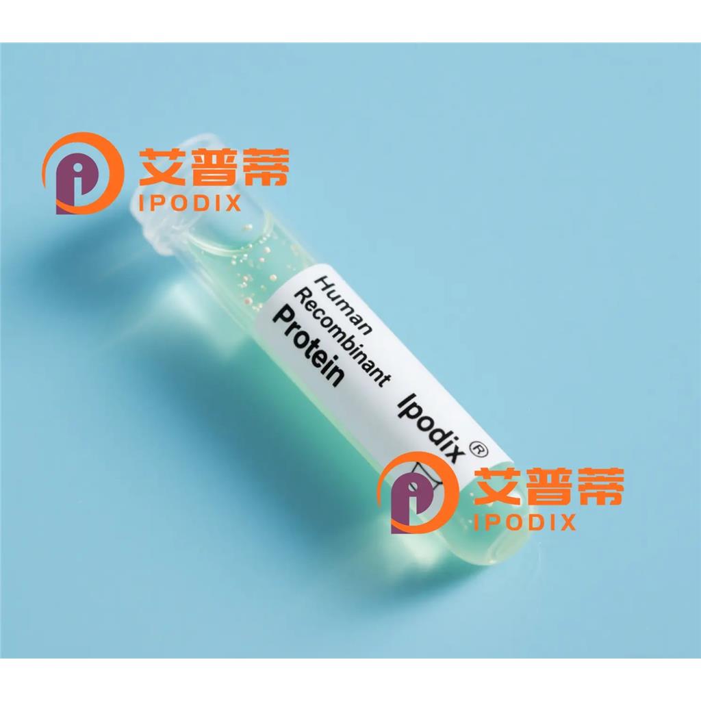 Ceruloplasmin抗体;Ceruloplasmin Antibody—艾普蒂